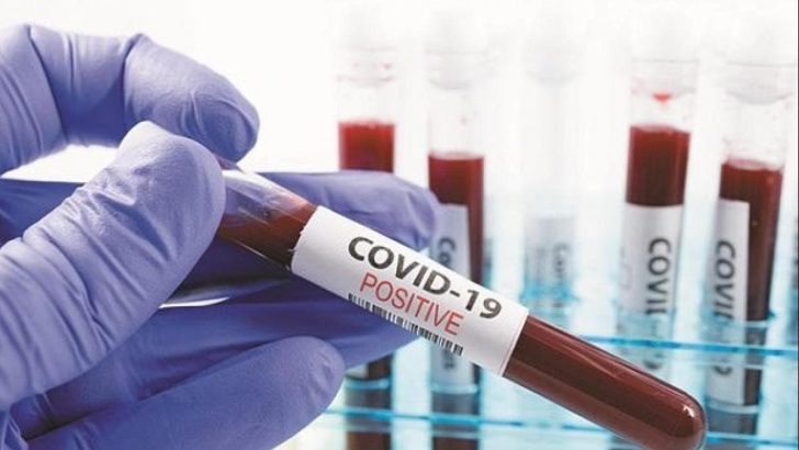 Bioethics questions as experimental drug is used in Covid-19 treatment