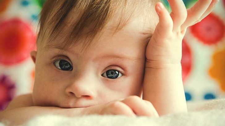 German bishops concerned prenatal Down syndrome test will become routine