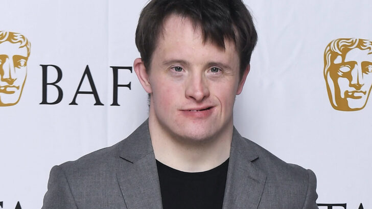 Actor takes on Hollywood to rewrite Down Syndrome roles